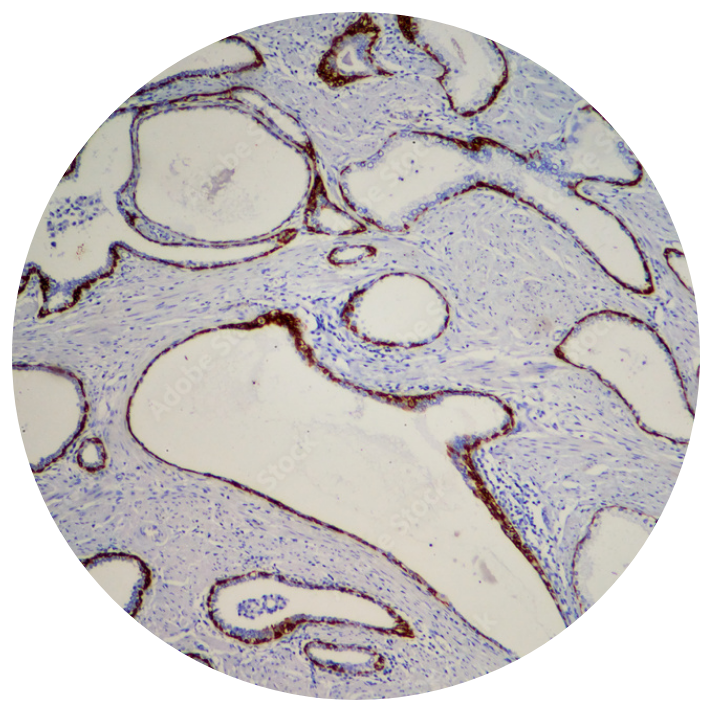 Anatomic Pathology